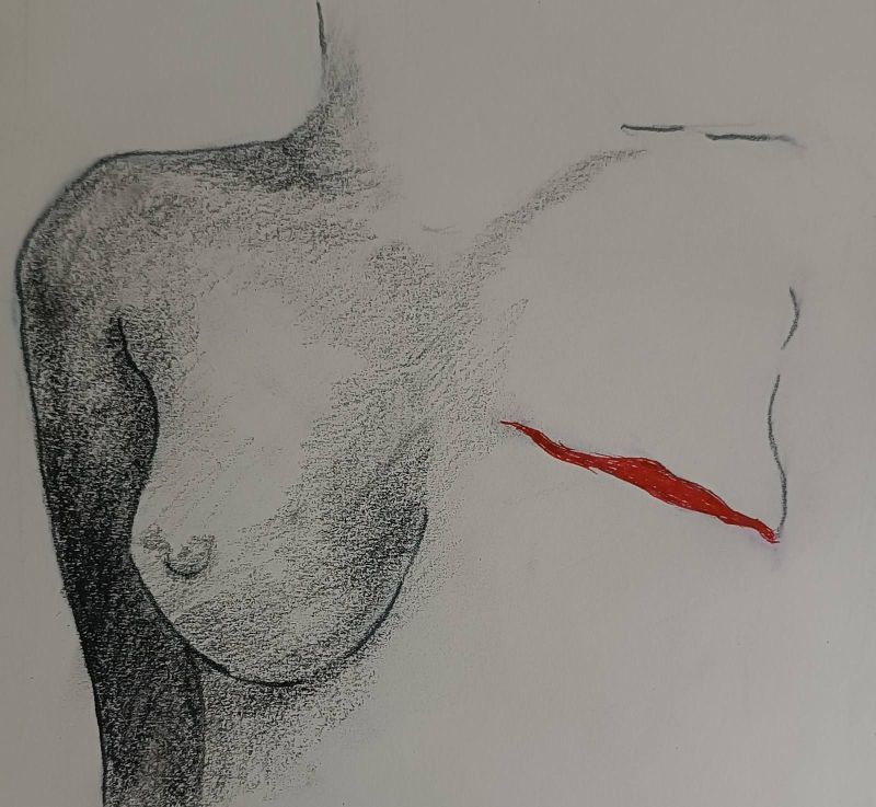 Veliki broj žena obolelih od raka dojke